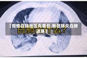 【疫情白肺地区有哪些,新冠肺炎白肺进展】
