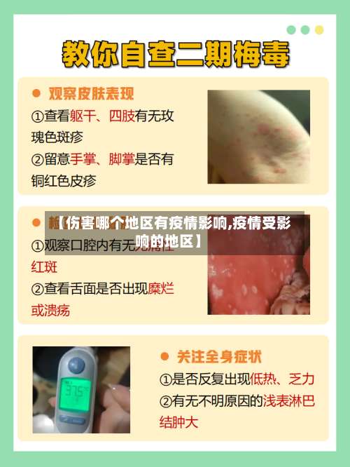 【伤害哪个地区有疫情影响,疫情受影响的地区】-第1张图片